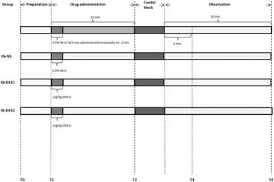 A randomized double-blinded study assessing the effect of different doses of transnasal dexmedetomidine on the median effective concentration of ropivacaine for a caudal block